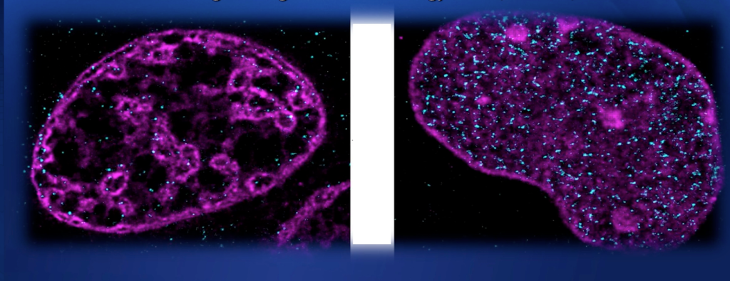 Comparison of an oxygen-deprived cell nucleus and a healthy, oxygenated nucleus.